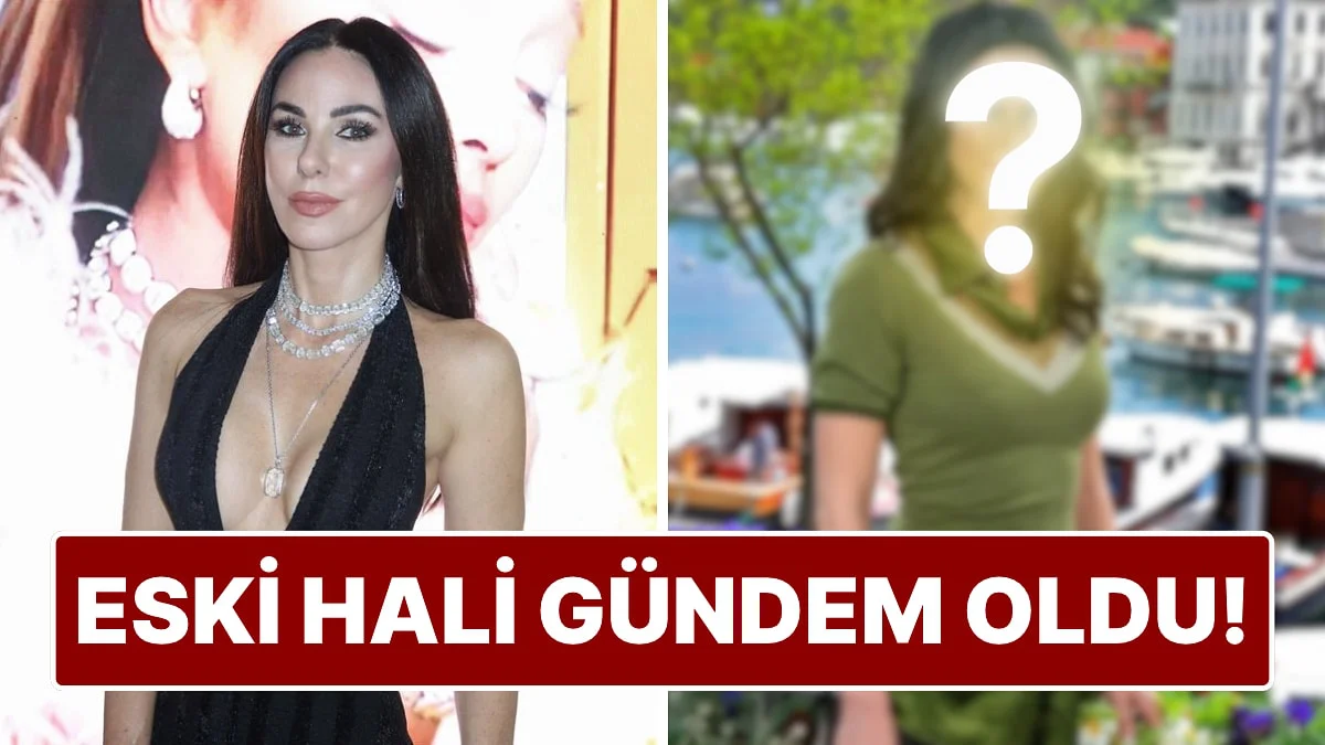 Güzelliğiyle Konuşulan Defne Samyeli, Kendini En Çirkin Hissettiği Dönemi Açıkladı!